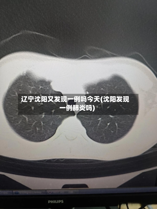 辽宁沈阳又发现一例吗今天(沈阳发现一例肺炎吗)-第1张图片