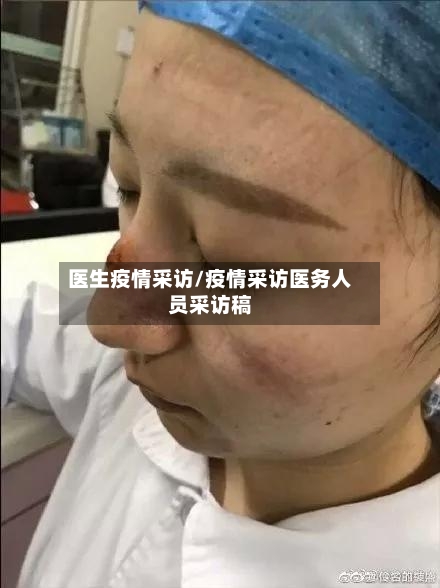 医生疫情采访/疫情采访医务人员采访稿-第3张图片